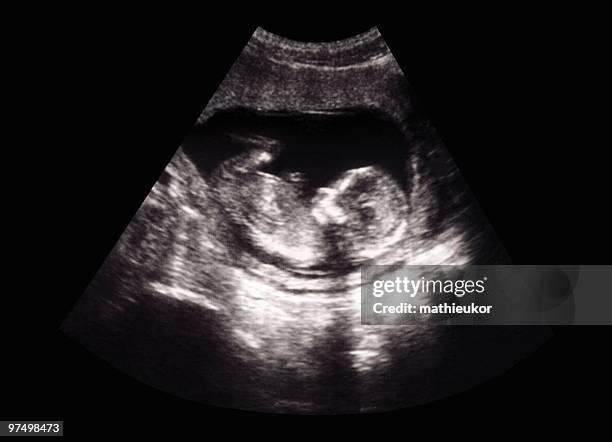 Absurdo: Feto humano é encontrado em estação de tratamento de esgoto em Medianeira