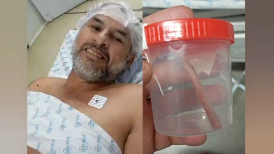 Inusitdo: Pescador atacado por peixe cachara passa por cirurgia e está fora de perigo