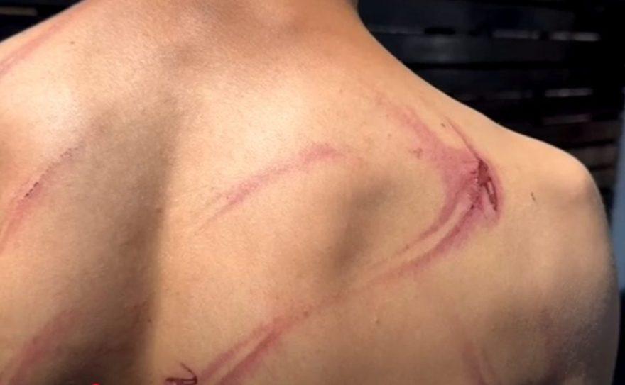 Região: Pai flagra jovem no quarto da filha e espanca adolescente com mangueira